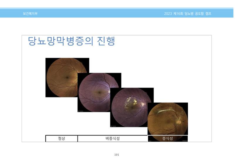 한국소아당뇨인협회 16회 공도함 캠프 E북 자료집 191페이지