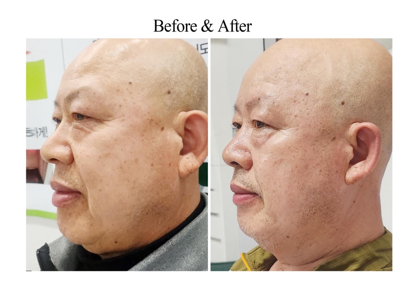 내몸이맑아지는 14페이지